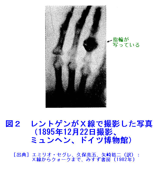 図２  レントゲンがＸ線で撮影した写真