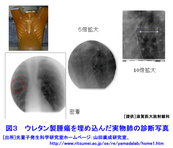 ウレタン製腫瘍を埋め込んだ実物肺の診断写真