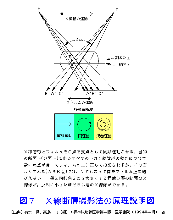 図７  Ｘ線断層撮影法の原理説明図