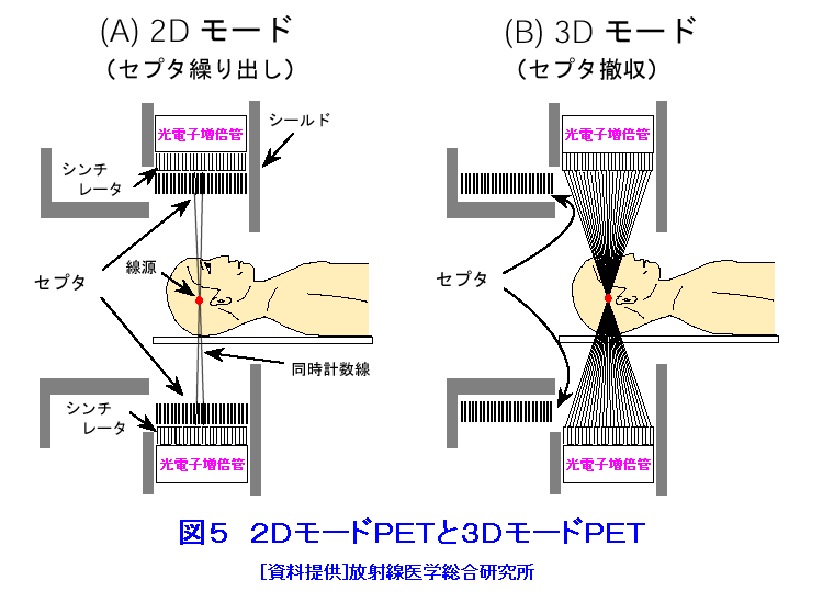 図５  2DモードPETと3DモードPET