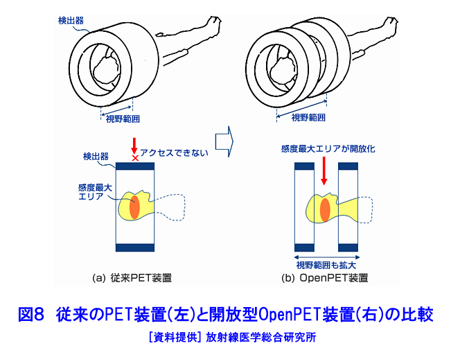 図８  従来のPET装置（左）と開放型OpenPET装置の比較