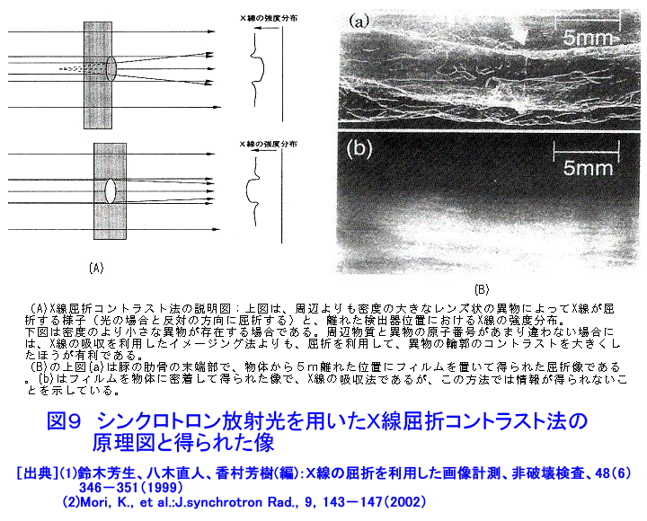 シンクロトロン放射光を用いたＸ線屈折コントラスト法の原理図と得られた像