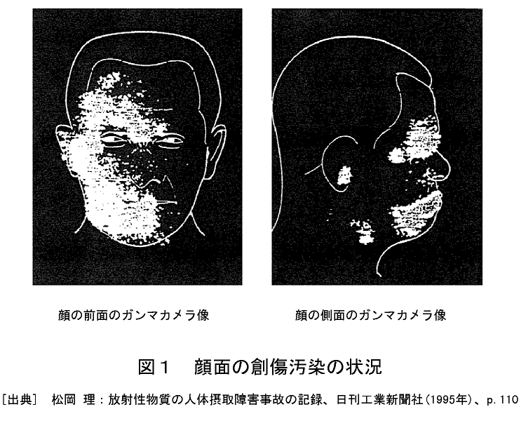 図１  顔面の創傷汚染の状況