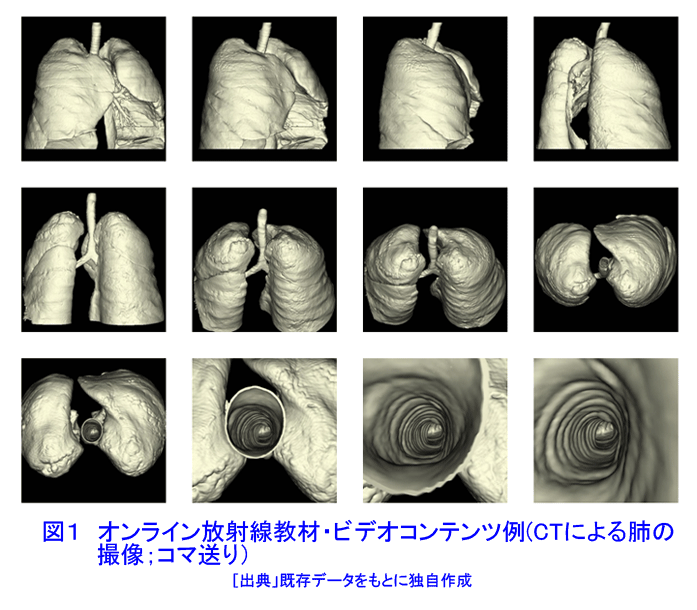 図１  オンライン放射線教材・ビデオコンテンツ例（CTによる肺の撮像；コマ送り）